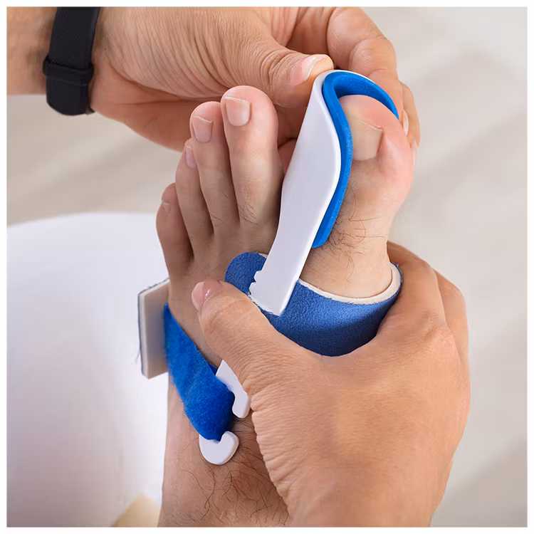 Hallux valgus Nachtbandage