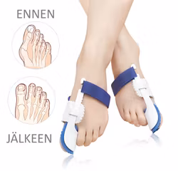 Vaivaisenluu korjaava tukilasta 2kpl