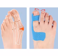 Kinesioteippi hallux valgus 10kpl , valmiiksi leikattu BEIGE