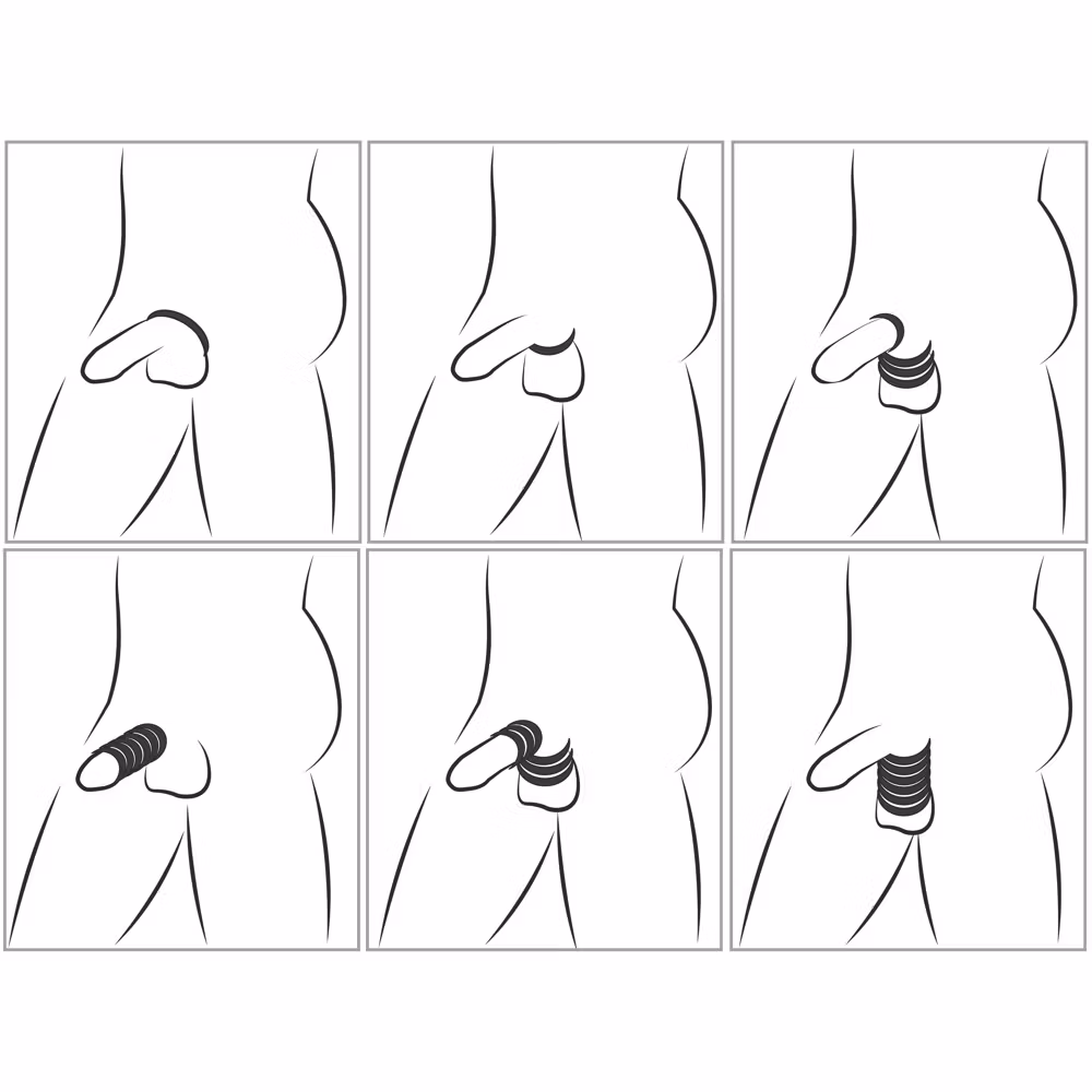 Cock & Ball Stretching Kit