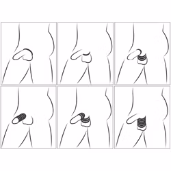 Cock & Ball Stretching Kit