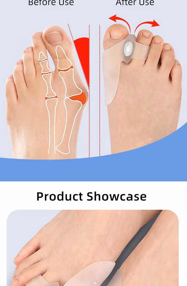 Justerbar tåavskiljare Modell 034