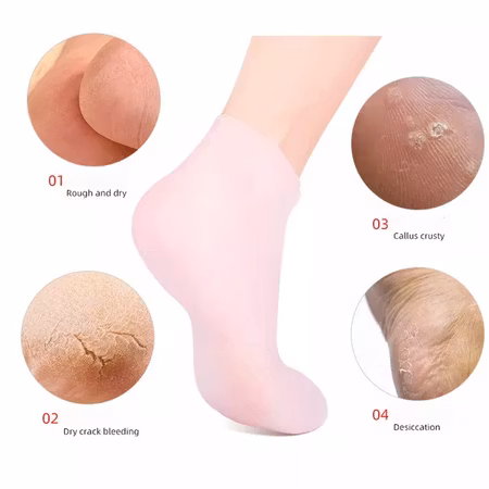 Mjukgörande gelsocka