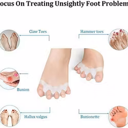 Tåseparerare - Tåskiljare