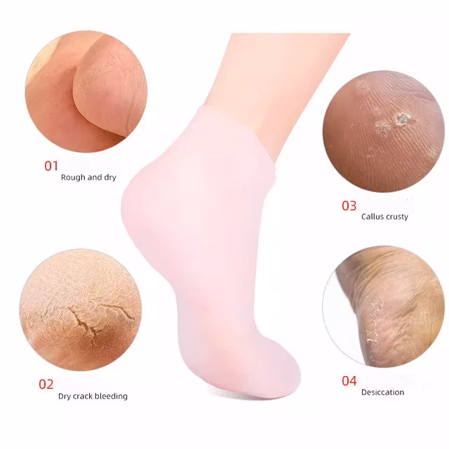 Mjukgörande gelsocka