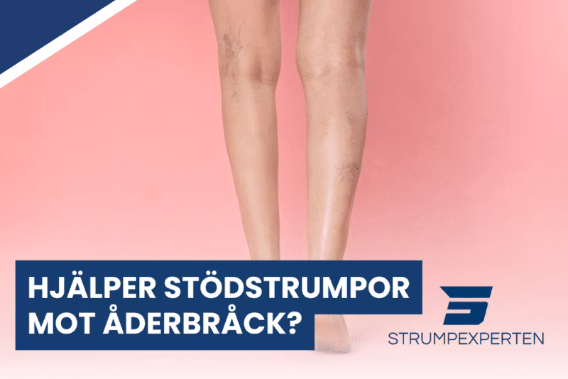 Hjälper stödstrumpor mot åderbråck?