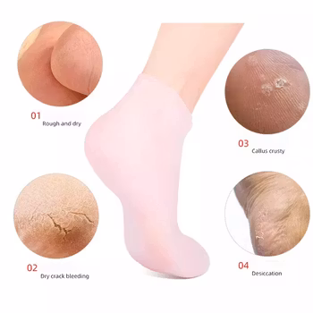 Mjukgörande gelsocka