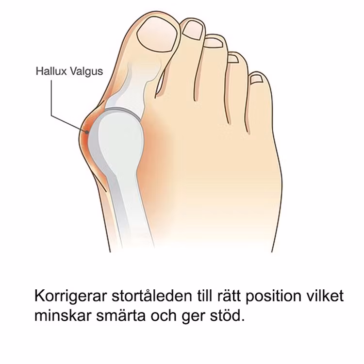 Hallux valgus-beskytter i silikon