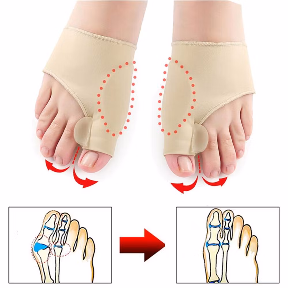 Hallux valgus-støtte (2 stk)