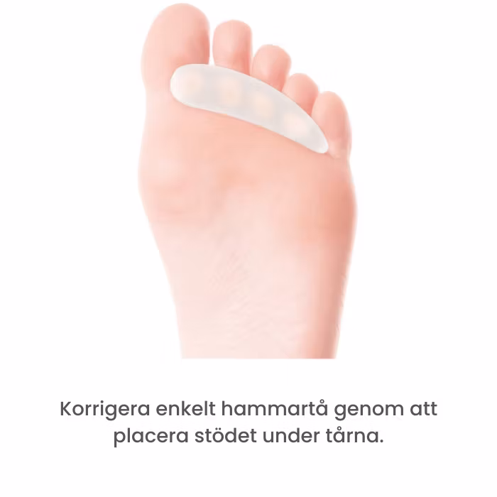 Hammertå (2 støtter)
