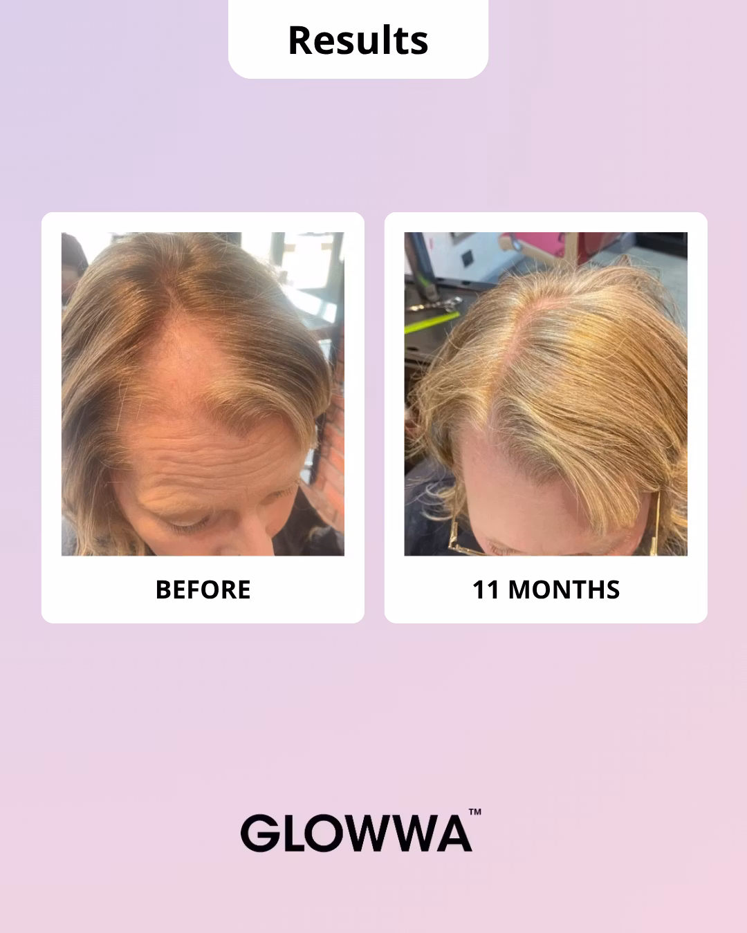 Glowwa MENO