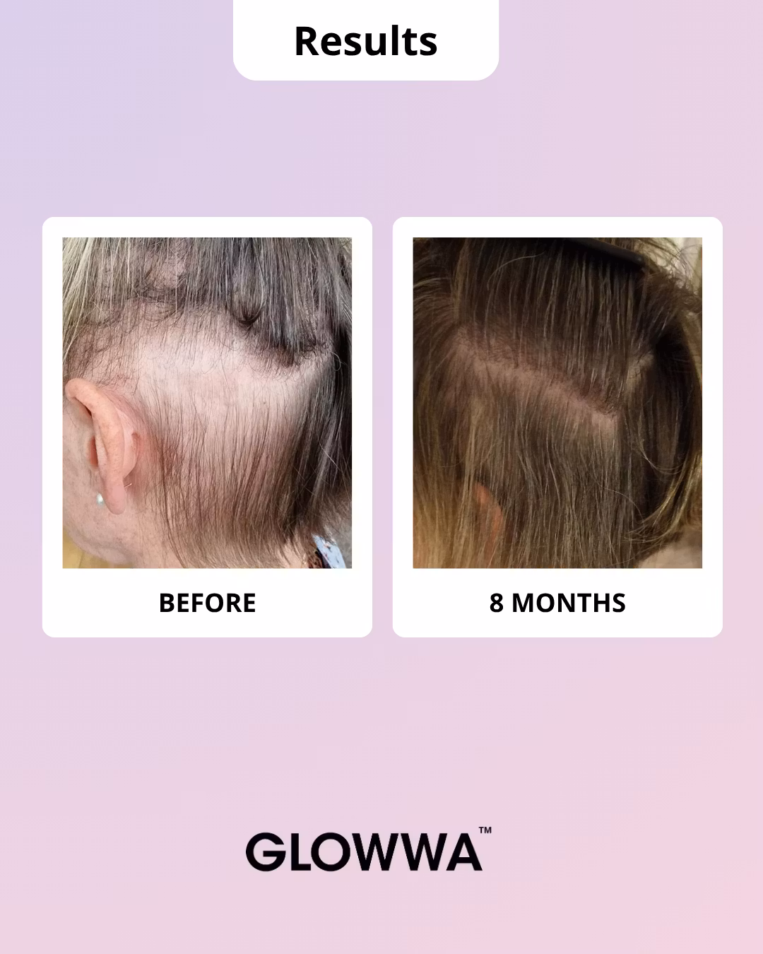 Glowwa MENO