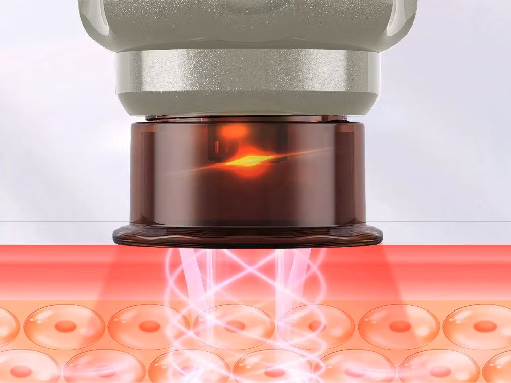 Kinesisk koppningsvakuummassageapparat med 12 sugeffektnivåer